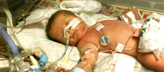 zofran birth defects lawsuit