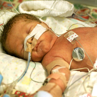 infant in intensive care